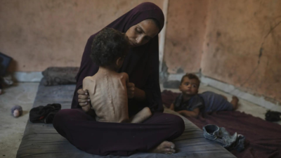 Image used for representative purposes 'Walking corpses': Photos of malnourished Gaza toddler go viral as humanitarian situation worsens; see pics inside