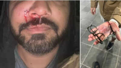 'Leaving me bleeding on the pavement': Indian-origin AI scientist Santosh Yadav attacked in Dublin, says it's not an isolated incident