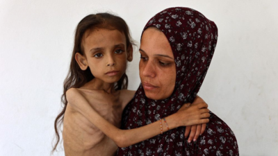 Her bones tell Gaza story, but Grok thinks it is Yemen: Musk's chatbot flagged for false claims on starving girl photo - Can AI be trusted?
