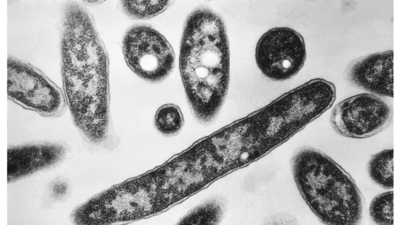California plague case: Lake Tahoe resident bitten by infected flea, contracts plague (Representative image) California plague case: Lake Tahoe resident bitten by infected flea, contracts plague; patient under medical supervision