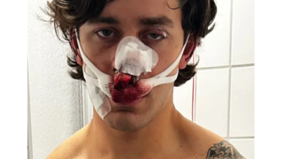 John Rudat, a 21-yr-old NY model was knifed in Germany while trying to save 2 women (Source: Instagram/@JohnRudat) US man stabbed in Germany: 21-yr-old NY model severely injured while trying to save 2 women from local thugs; who is John Rudat?