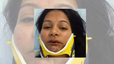 An Indian couple claimed they were brutally attacked by a Chinese person at a hotel in Switzerland, unprovoked. 'I don't feel like myself anymore': Indian-origin couple's story of being punched, kicked by Chinese man at Switzerland hotel goes viral