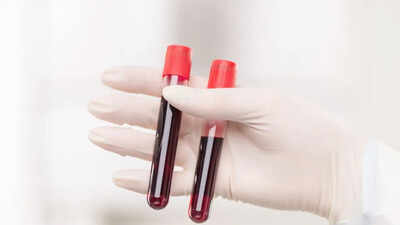 World’s rarest hybrid blood type discovered in Thailand: Study found in just 3 people out of a massive research of 544,000 samples